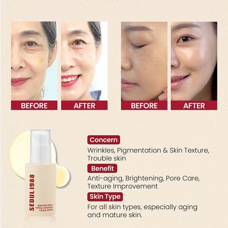 1/2PCS Korean SEOUL 1988 Retinol Face Serum Fade Fine Wrinkle Moisturizing Whitening Remove Spots Shrink Pores Beauty Skin Care - MacroPanora