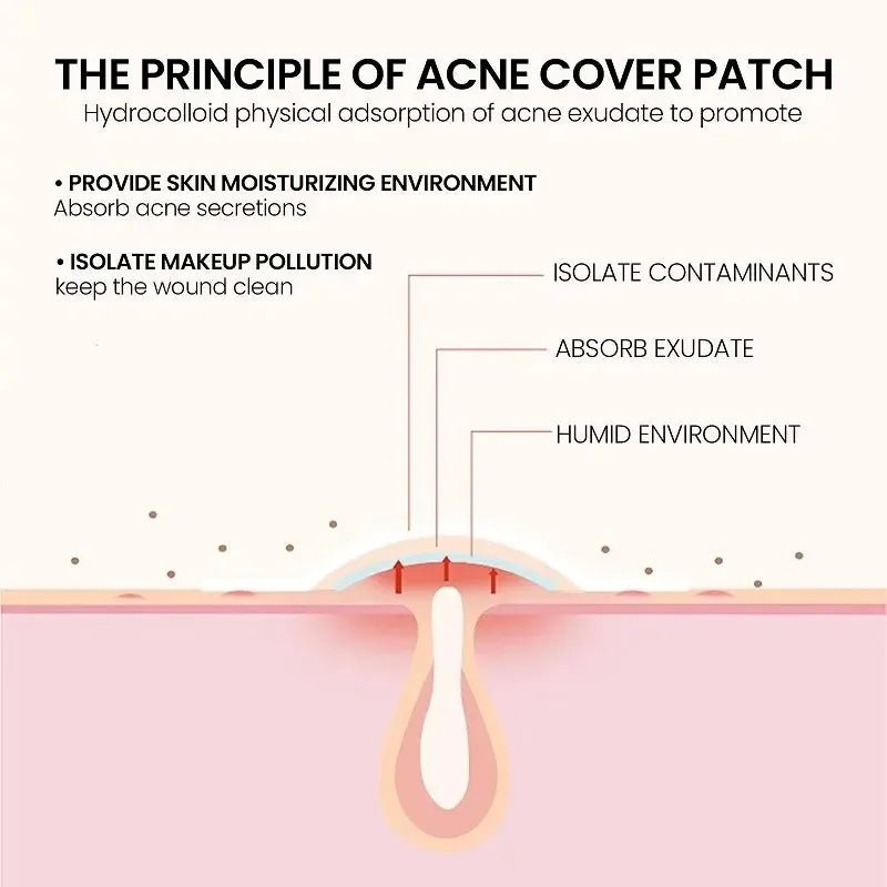 200Pcs Repair Acne Patch Facial Skin Care Fade Blemishes Pimple Marks Closed Acne Blemishes Cover Acne Pimple Repair Patch - MacroPanora