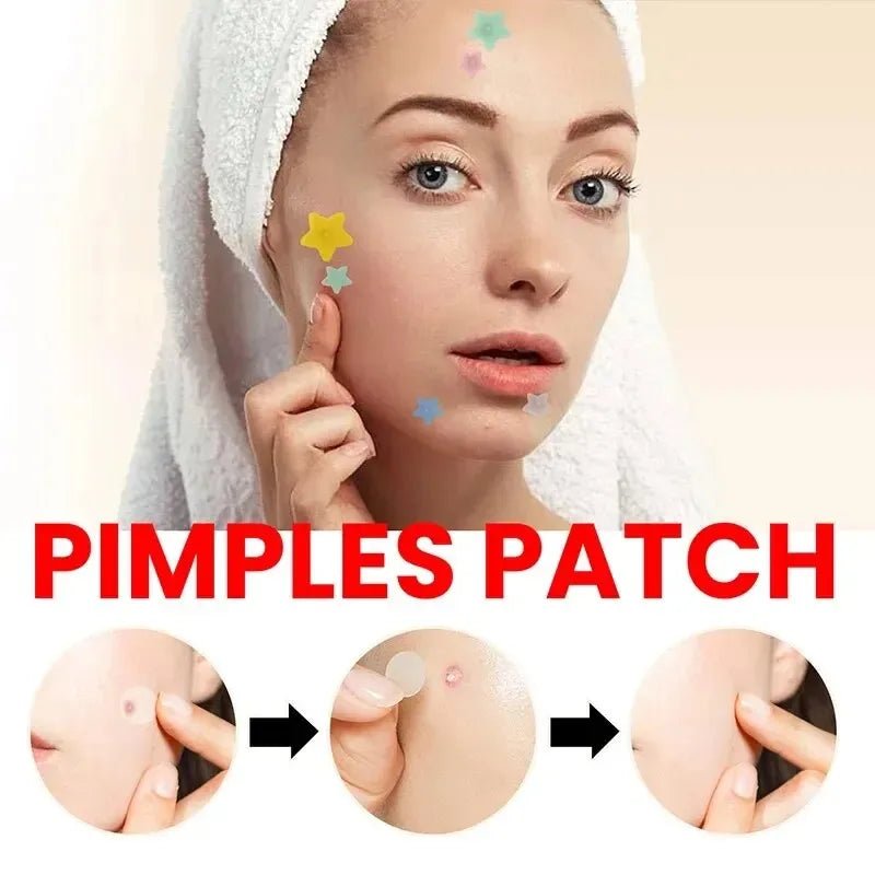 200Pcs Repair Acne Patch Facial Skin Care Fade Blemishes Pimple Marks Closed Acne Blemishes Cover Acne Pimple Repair Patch - MacroPanora