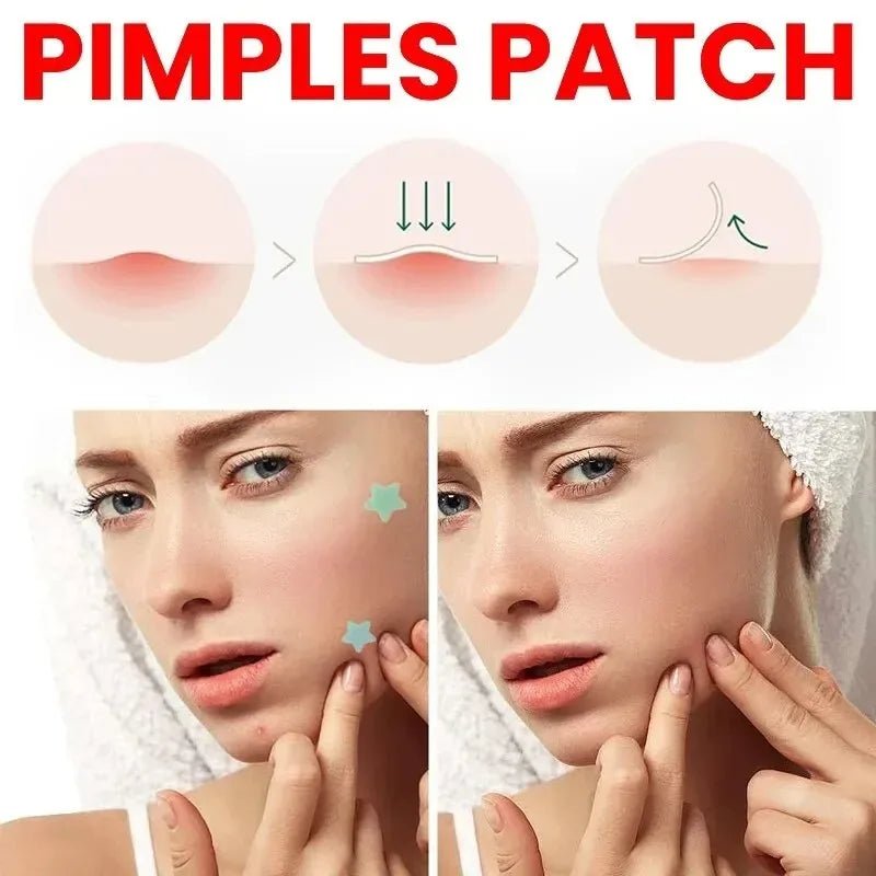200Pcs Repair Acne Patch Facial Skin Care Fade Blemishes Pimple Marks Closed Acne Blemishes Cover Acne Pimple Repair Patch - MacroPanora
