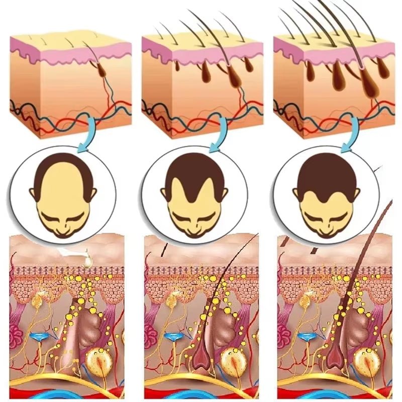 7 Days Ginger Hair Growth Serum Fast Promote Hair Regrowth Products anti Hair Loss Repair Scalp Baldness Nourish Hair Root Care - MacroPanora