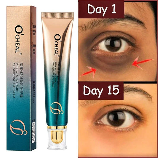 Anti Wrinkle Eye Cream Retinol Fade Fine Lines Anti - Dark Circles Remove Eye Bags Anti - Aging Firming Eye Serum Eye Care Cream - MacroPanora