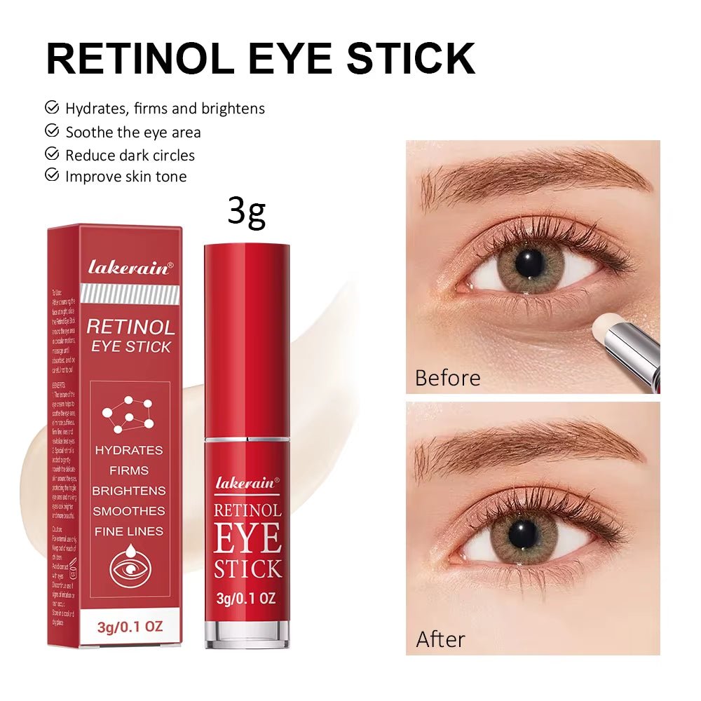 Retinol Eye Cream Stick: Anti-Wrinkle Dark Circle Remover for Lifting, Moisturizing & Brightening - MacroPanora