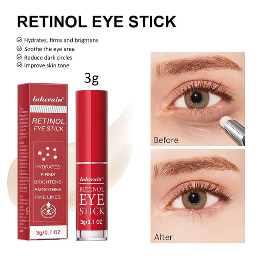 Retinol Eye Cream Stick: Anti-Wrinkle Dark Circle Remover for Lifting, Moisturizing & Brightening - MacroPanora