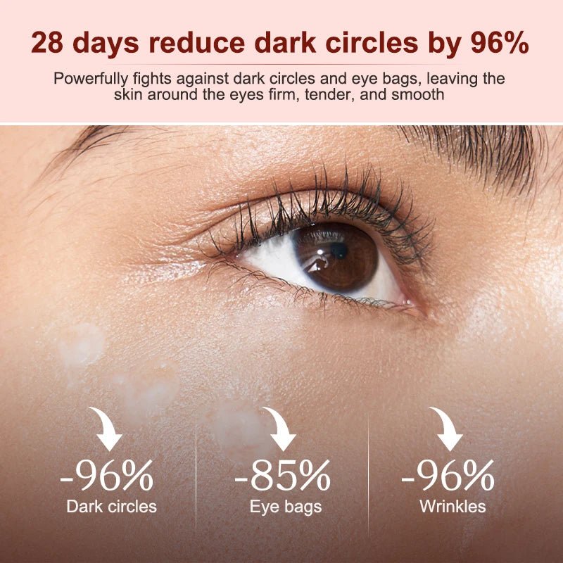 Astaxanthin Dark Circles Remover Eye Bags Eye Cream anti Wrinkle Firmness Moisturizing Eyes Serum Skin Care Beauty Products - MacroPanora