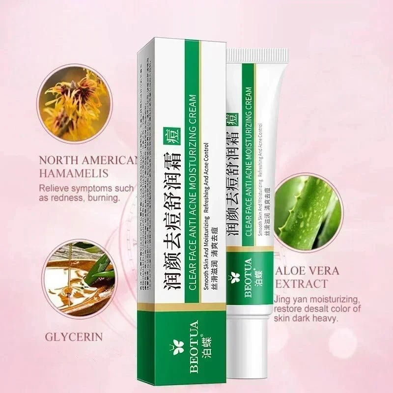 Herbal Acne Treatment Cream Face Scar Blackhead Remover Repair Gel Oil Control Shrink Pores Whitening Skin Care Korean Cosmetics - MacroPanora