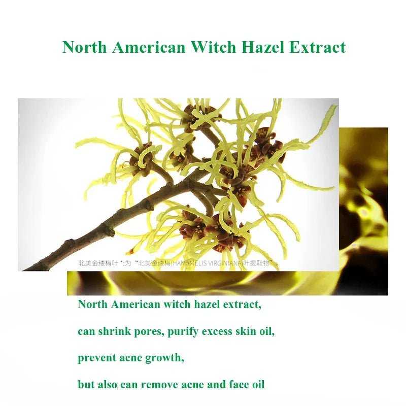 Herbal Acne Treatment Cream Face Scar Blackhead Remover Repair Gel Oil Control Shrink Pores Whitening Skin Care Korean Cosmetics - MacroPanora