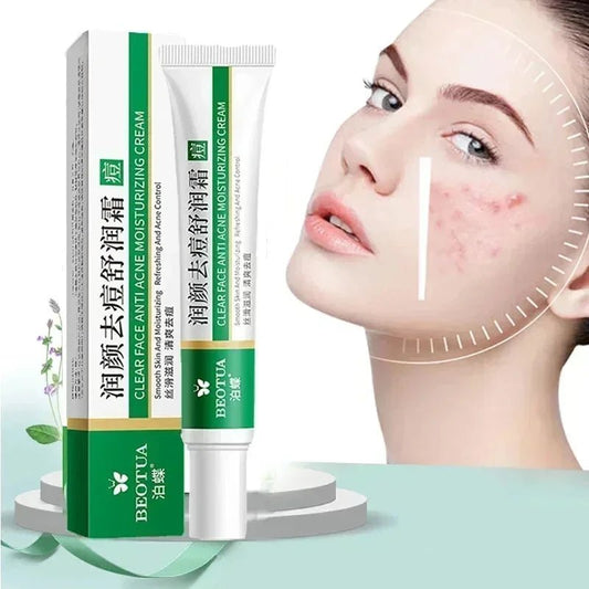 Herbal Acne Treatment Cream Face Scar Blackhead Remover Repair Gel Oil Control Shrink Pores Whitening Skin Care Korean Cosmetics - MacroPanora