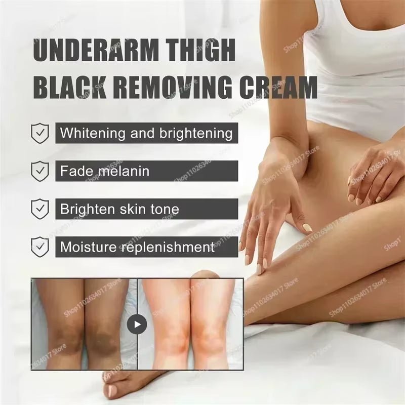 Hot~Whitening Cream Private Parts Underarm Bleaching Serum Whiten Butt Knee Brighten Inner Thigh Intimate Parts Dark Remove Mela - MacroPanora