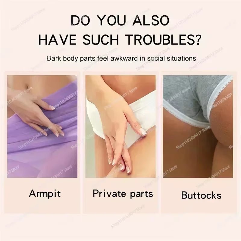 Hot~Whitening Cream Private Parts Underarm Bleaching Serum Whiten Butt Knee Brighten Inner Thigh Intimate Parts Dark Remove Mela - MacroPanora