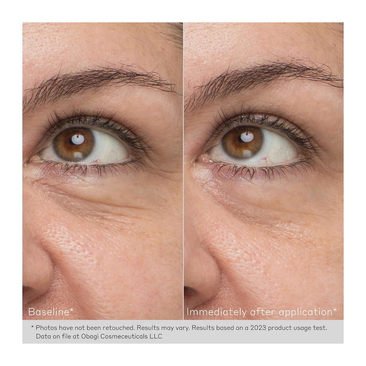 Obagi Daily Hydro Drops Rejuvenating Eye Gel Cream - MacroPanora