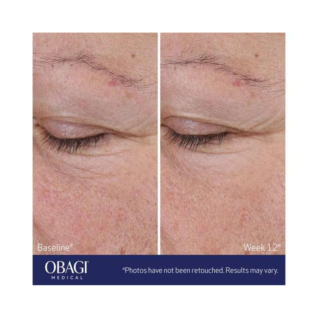 Obagi ELASTIderm® Advanced Filler Concentrate - Eyes, Neck & Lips | MacroPanora