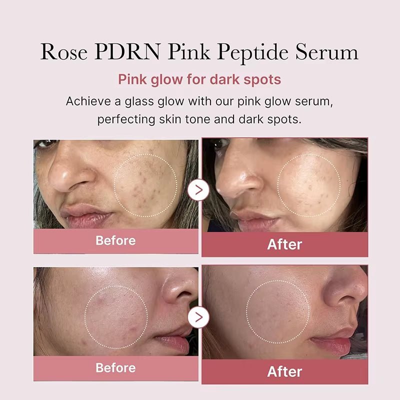 Korean Peptide Collagen Serum for Acne-Free Skin & Deep Hydration - MacroPanora