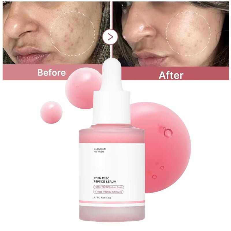 Korean Peptide Collagen Serum for Acne-Free Skin & Deep Hydration - MacroPanora