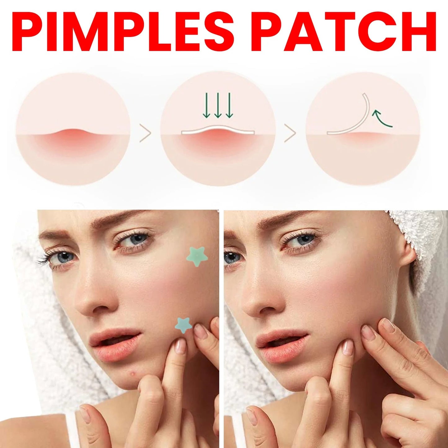 Repair Acne Patch Facial Skin Care Fade Blemishes Pimple Marks Closed Acne Blemishes Cover Acne Pimple Repair Patch - MacroPanora