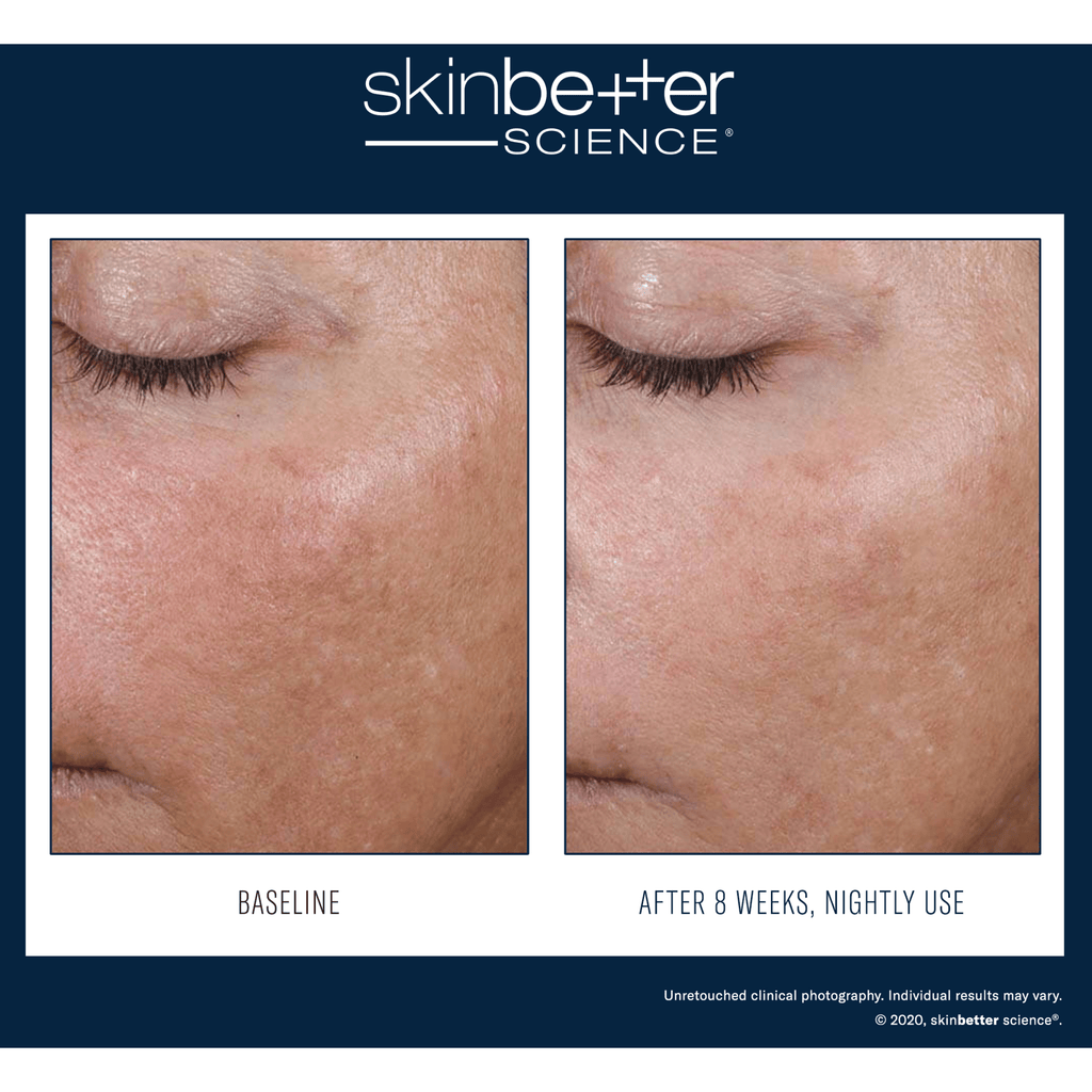 SkinBetter Alto Advanced Defense and Repair Serum - Serums, Oils & Concentrates | MacroPanora