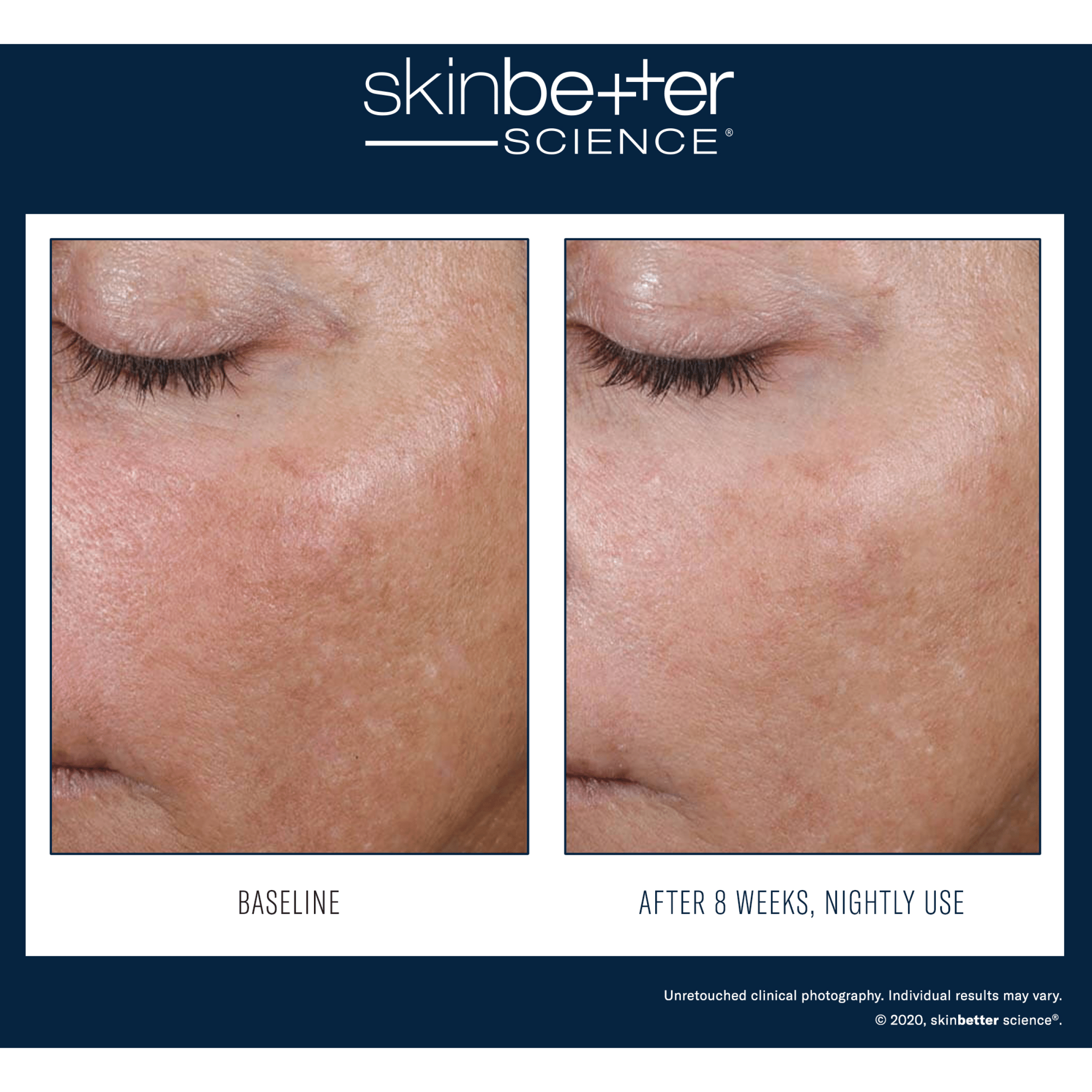 SkinBetter Alto Advanced Defense and Repair Serum - Serums, Oils & Concentrates | MacroPanora