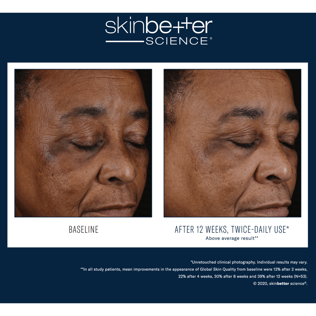 SkinBetter Mystro Active Balance Serum - Serums, Oils & Concentrates | MacroPanora