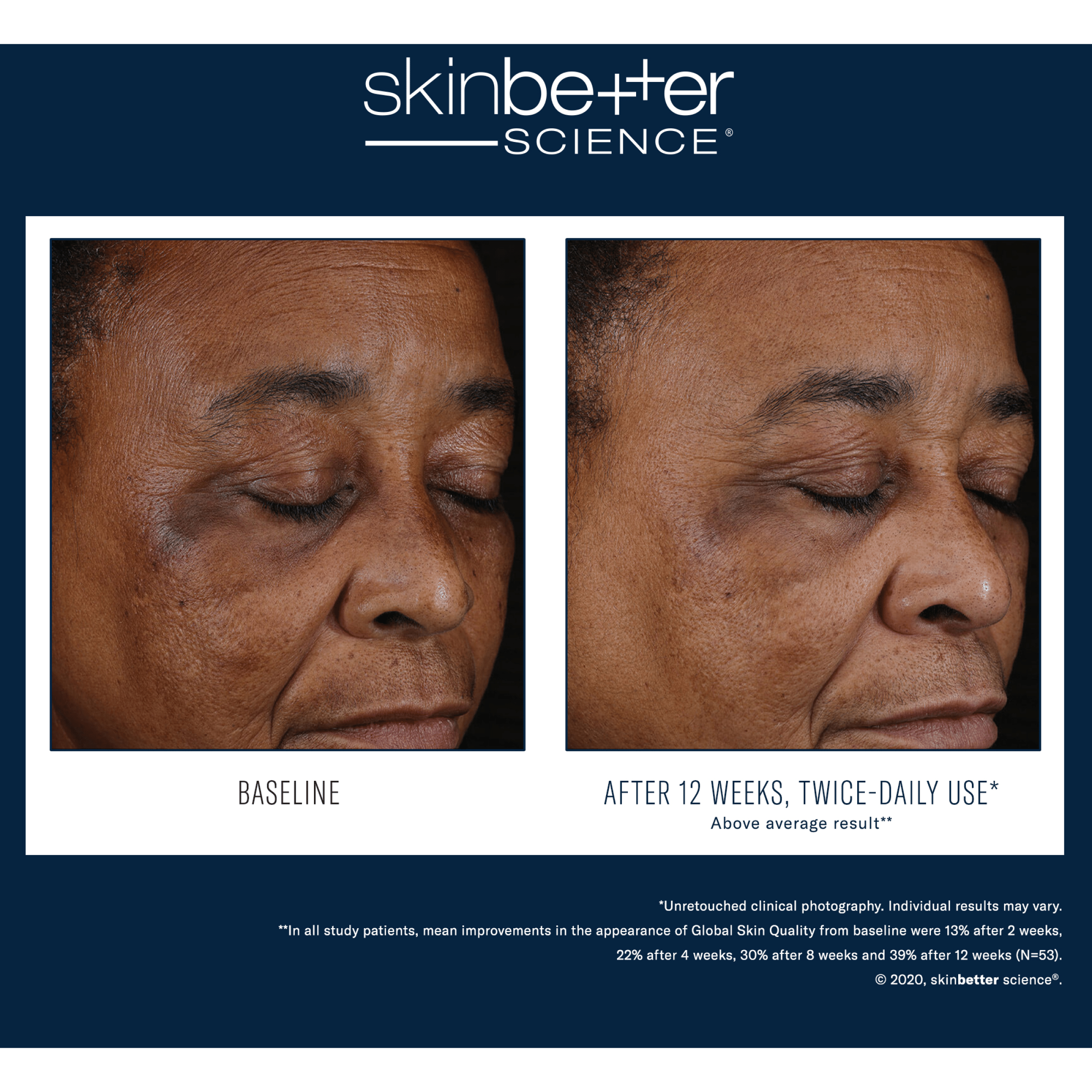 SkinBetter Mystro Active Balance Serum - Serums, Oils & Concentrates | MacroPanora