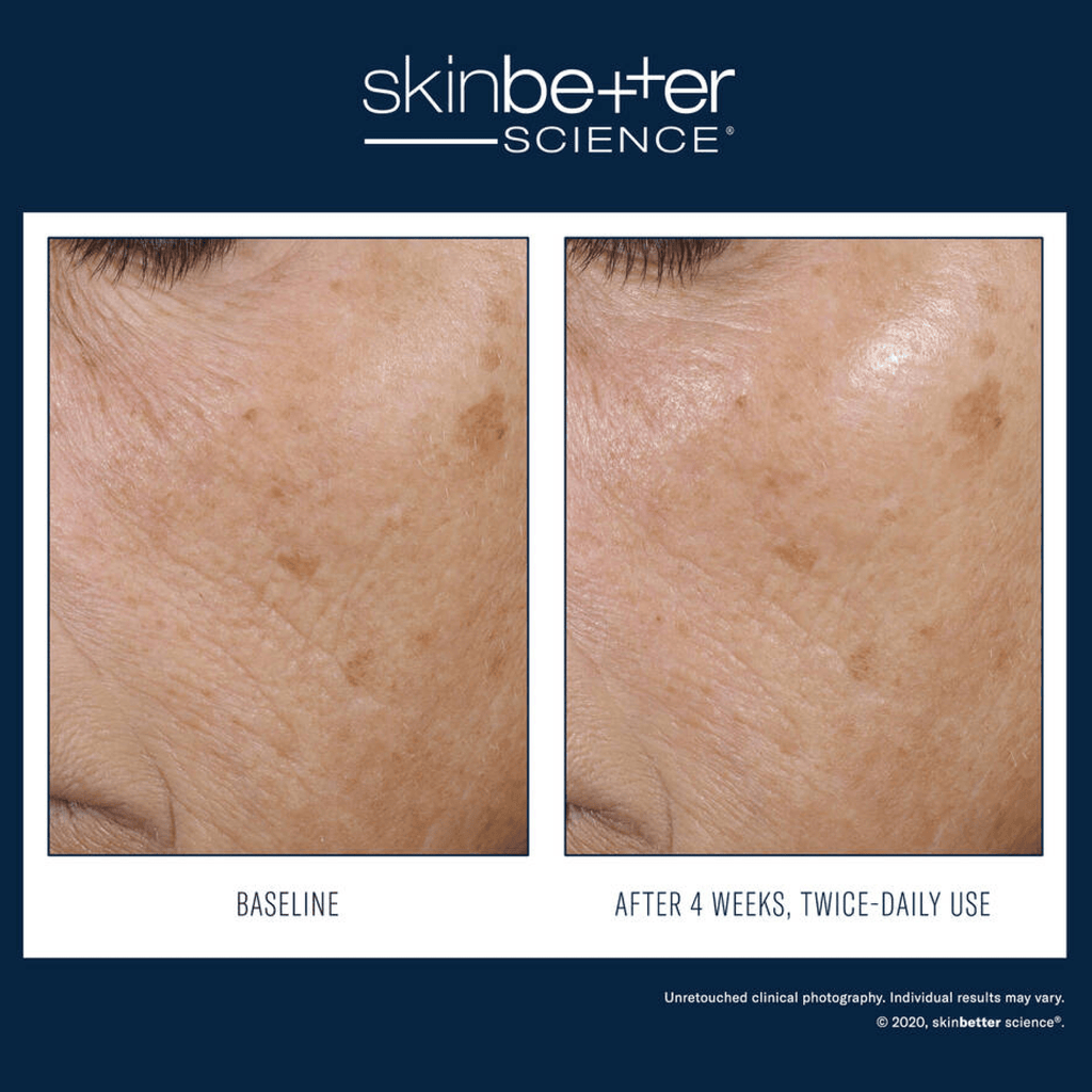 SkinBetter Trio Rebalancing Moisture Treatment - Moisturizers | MacroPanora