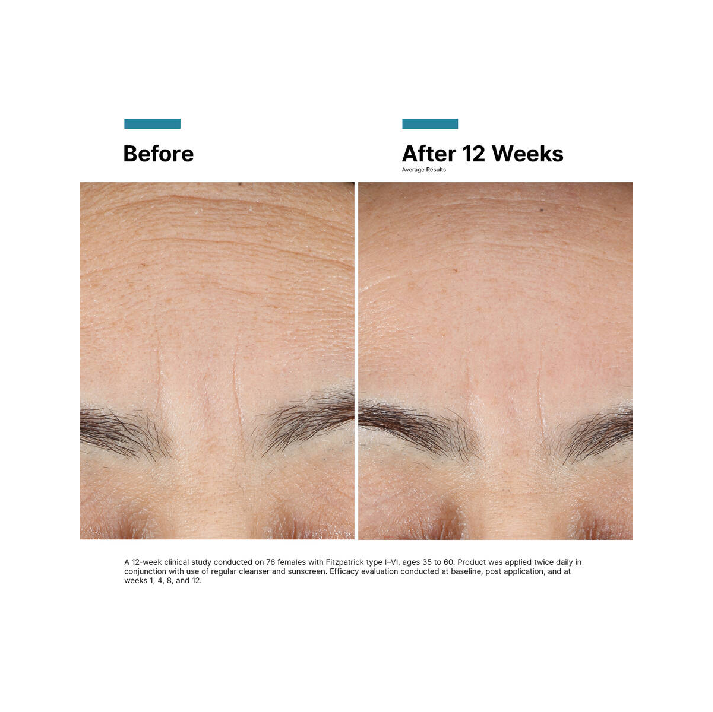 SkinCeuticals Advanced RGN-6 - Post-Procedure Care | MacroPanora