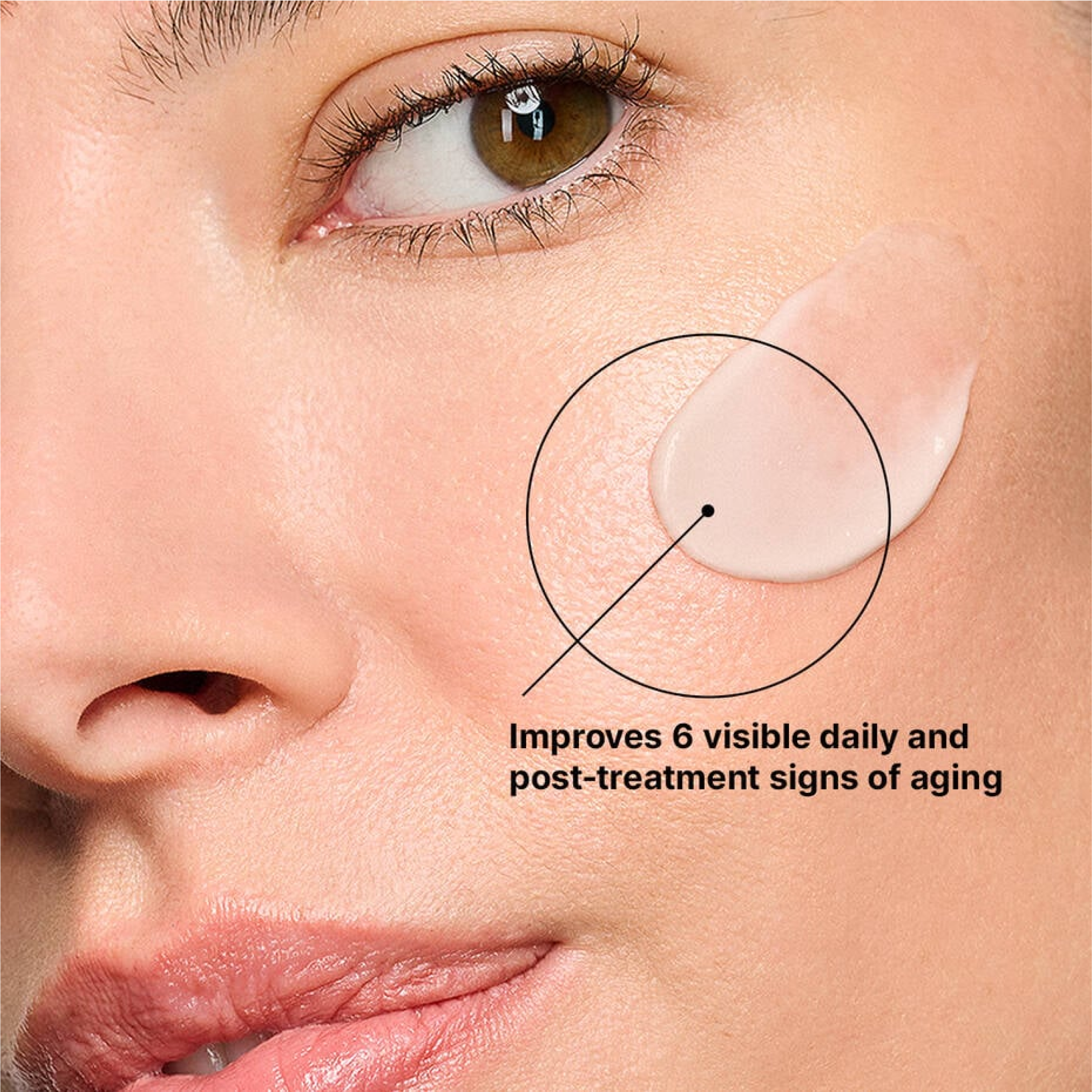 SkinCeuticals Advanced RGN-6 - Post-Procedure Care | MacroPanora