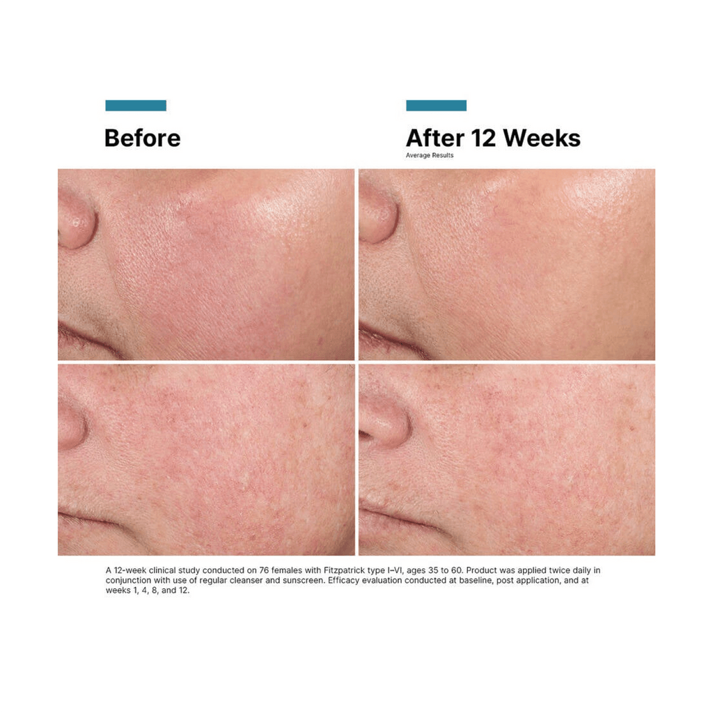 SkinCeuticals Advanced RGN-6 - Post-Procedure Care | MacroPanora