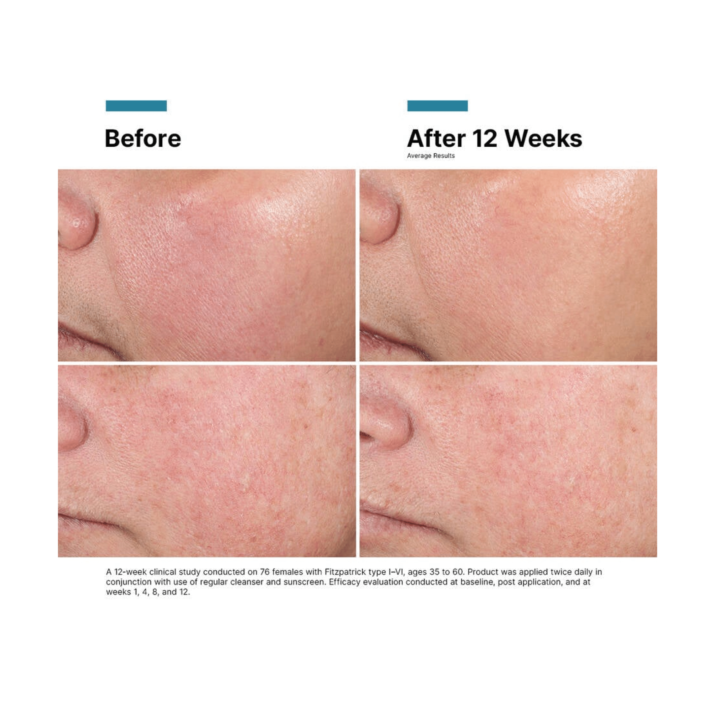 SkinCeuticals Advanced RGN-6 - Post-Procedure Care | MacroPanora