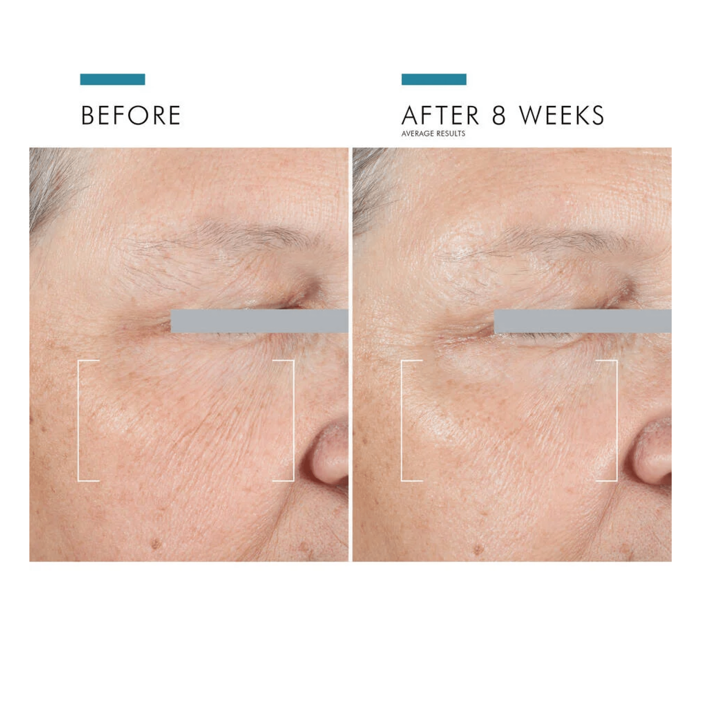 SkinCeuticals A.G.E. Advanced Eye - MacroPanora