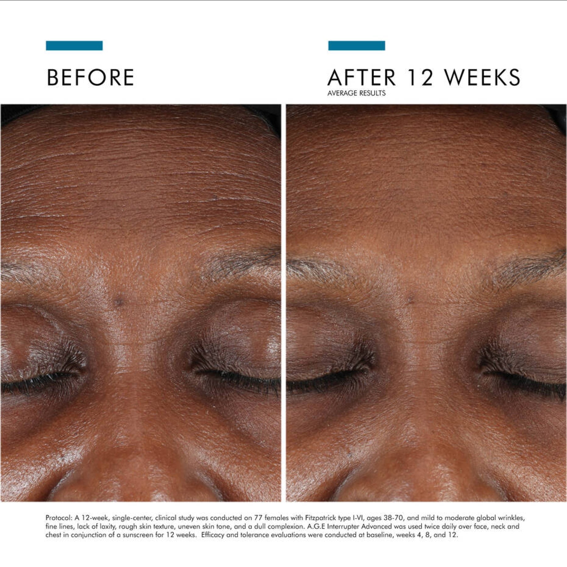 SkinCeuticals A.G.E. Interrupter Advanced - MacroPanora