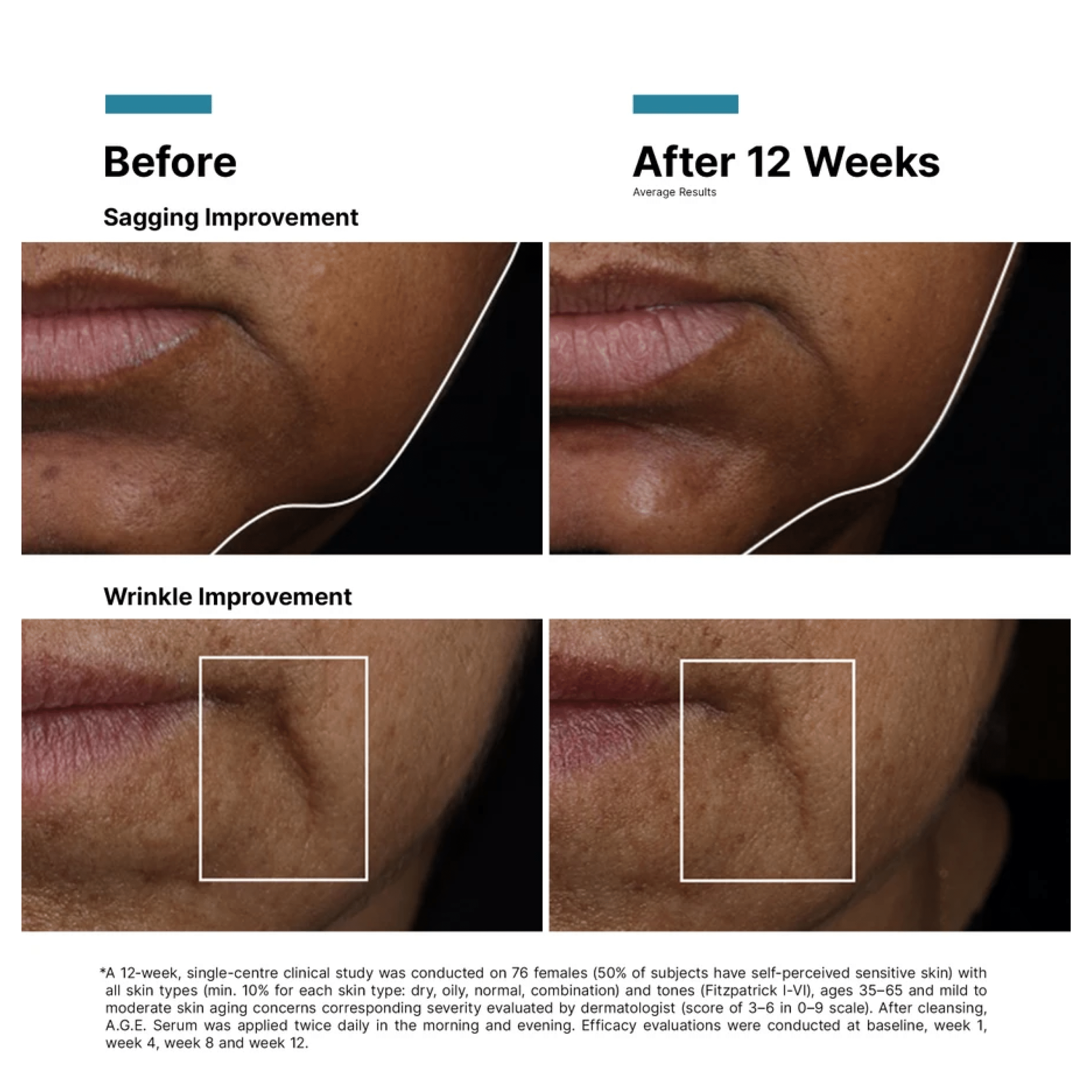 SkinCeuticals AGE Interrupter Ultra Serum - Serums, Oils & Concentrates | MacroPanora