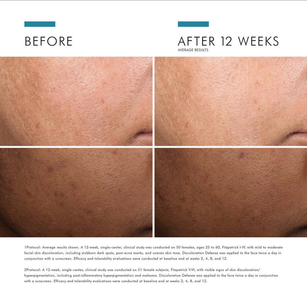 SkinCeuticals Discoloration Defense - MacroPanora