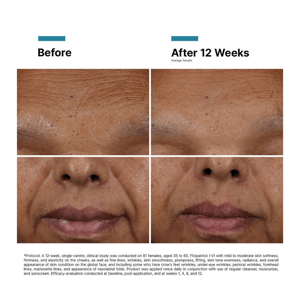 SkinCeuticals H.A. Intensifier Multi - Glycan - MacroPanora