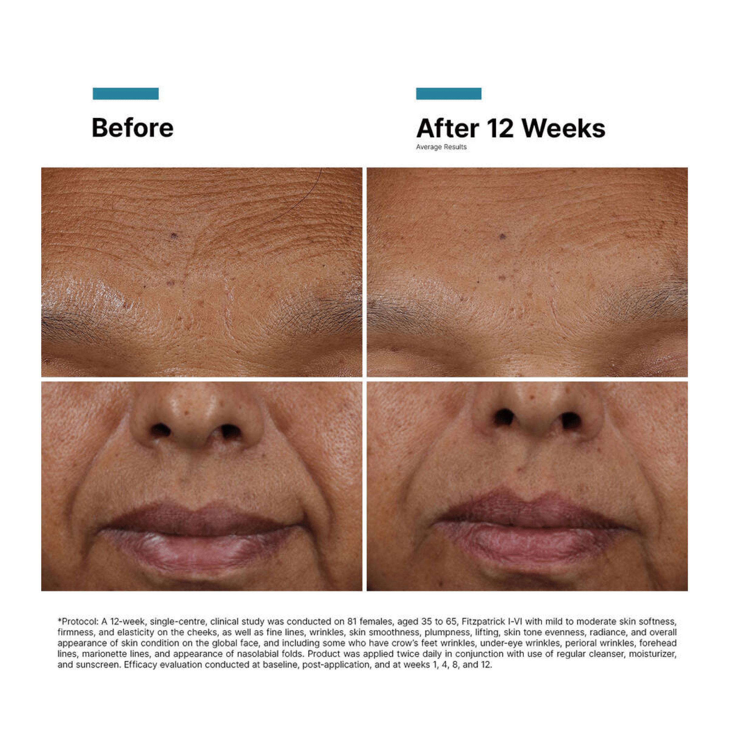 SkinCeuticals H.A. Intensifier Multi - Glycan - MacroPanora