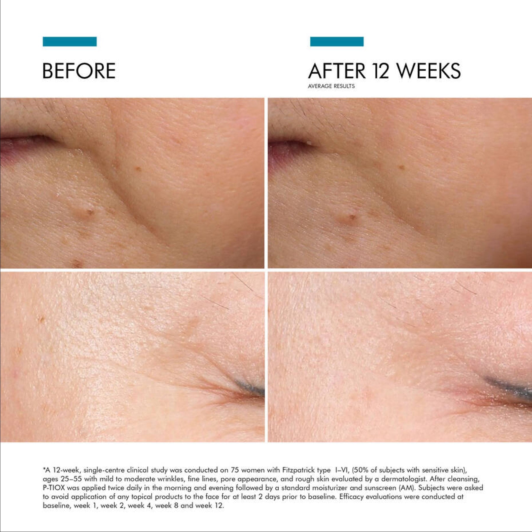 SkinCeuticals P-TIOX - Serums, Oils & Concentrates | MacroPanora