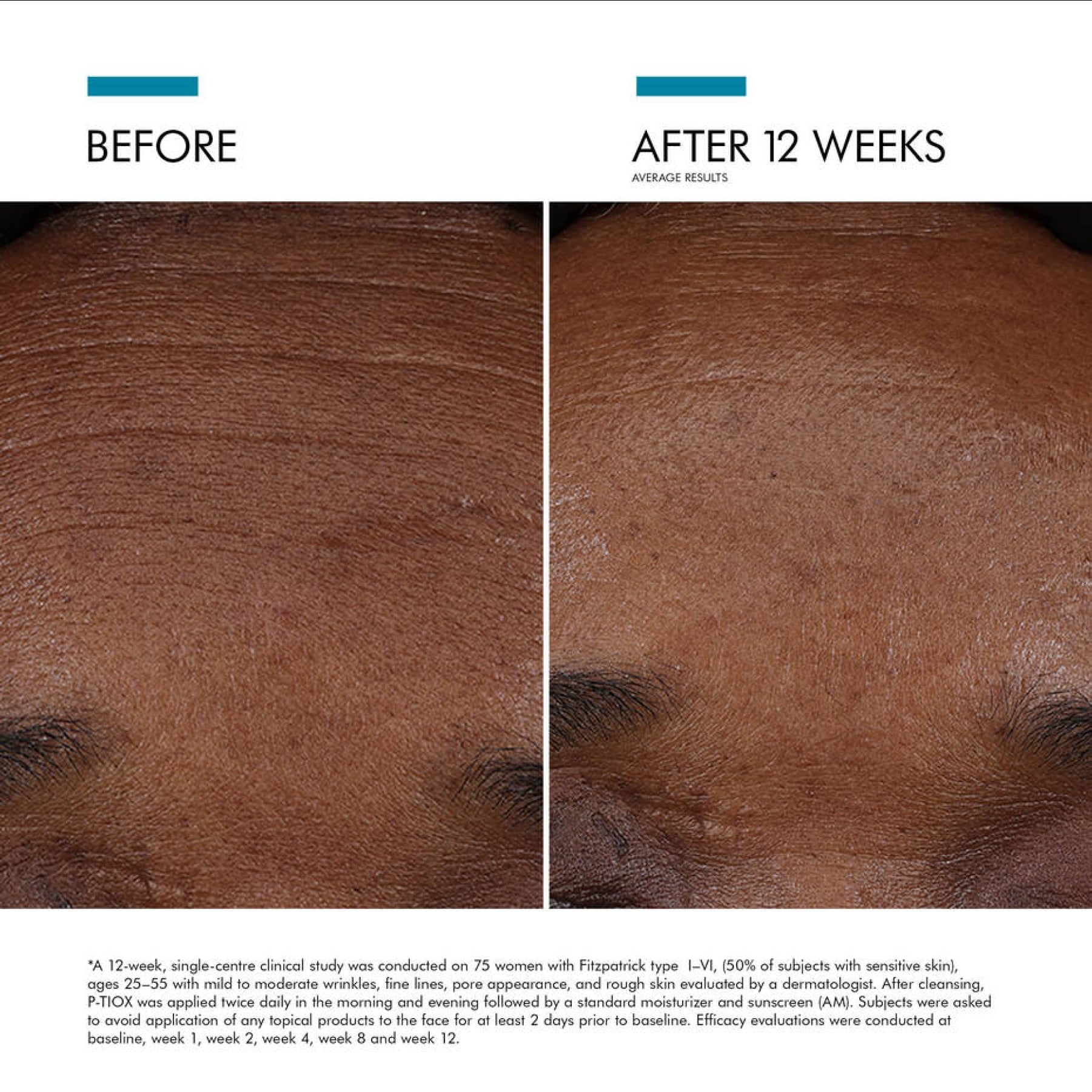 SkinCeuticals P-TIOX - Serums, Oils & Concentrates | MacroPanora