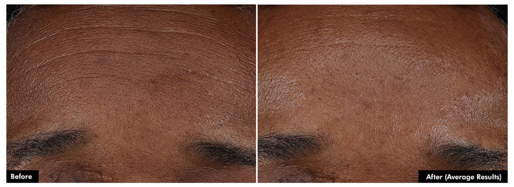 SkinCeuticals P-TIOX - Serums, Oils & Concentrates | MacroPanora