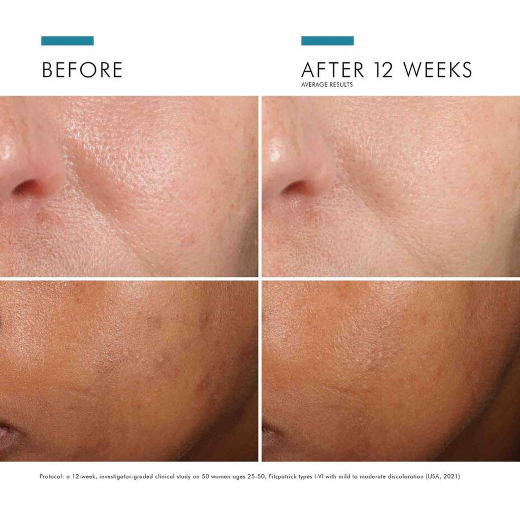 SkinCeuticals Phloretin CF® with Ferulic Acid - MacroPanora