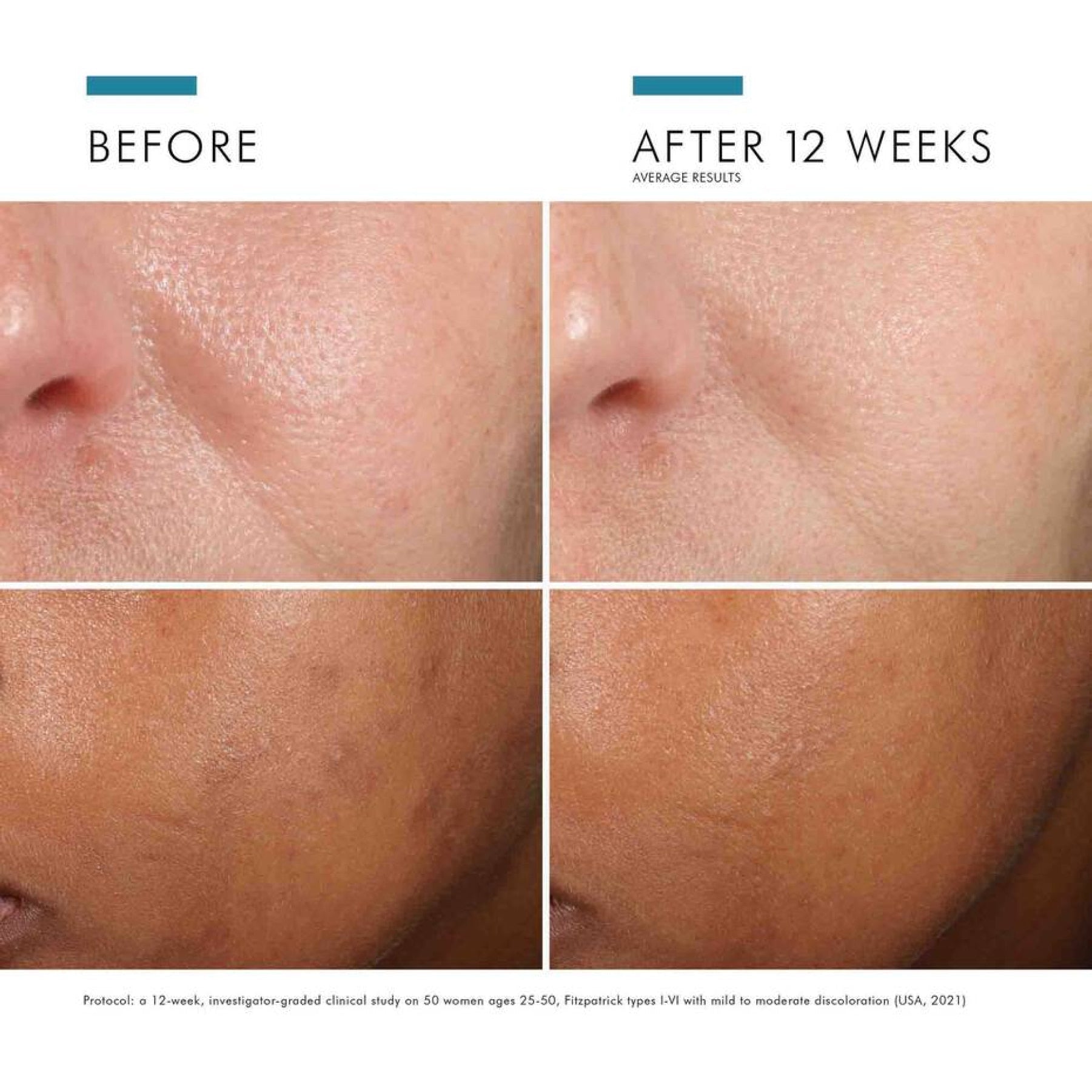 SkinCeuticals Phloretin CF® with Ferulic Acid - MacroPanora