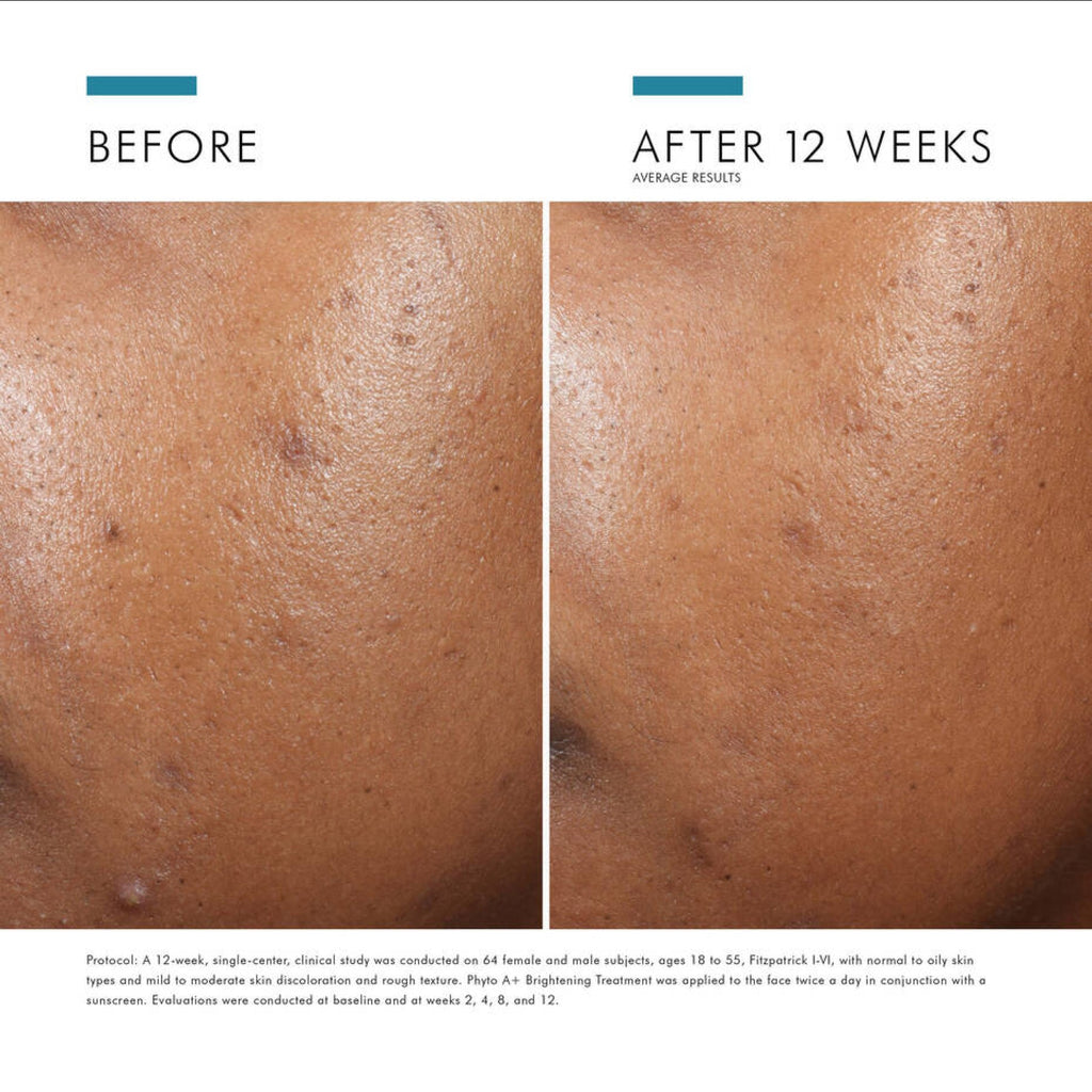 SkinCeuticals Phyto A+ Brightening Treatment - MacroPanora