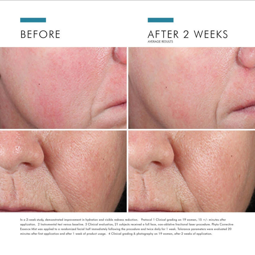 SkinCeuticals Phyto Corrective Essence Mist - MacroPanora