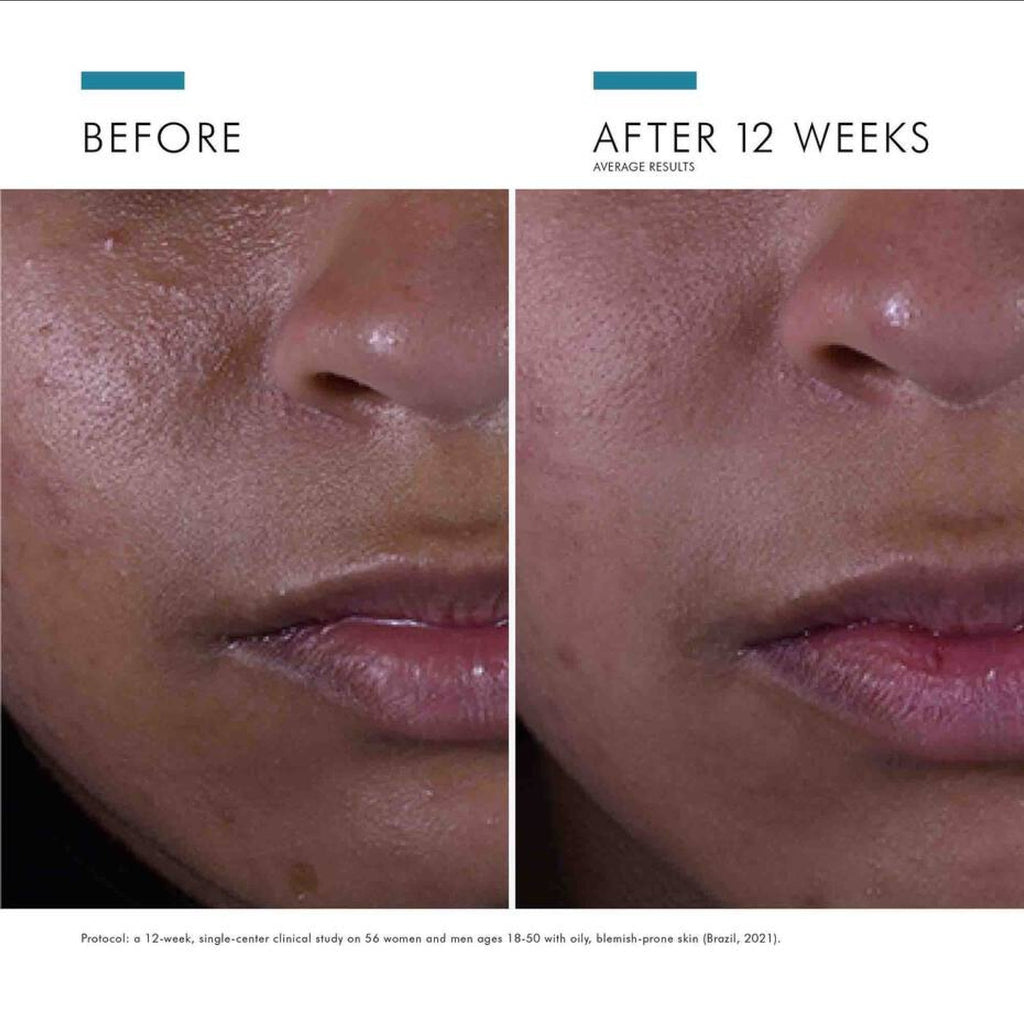 SkinCeuticals Silymarin CF - Serums, Oils & Concentrates | MacroPanora
