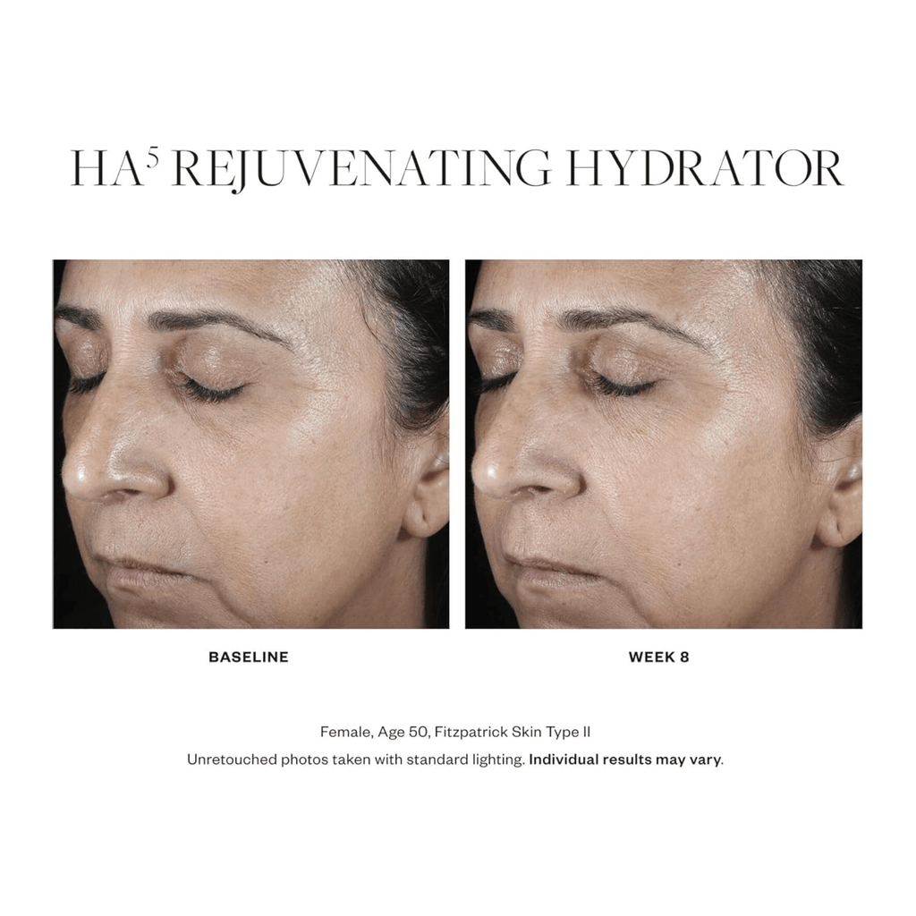 SkinMedica HA5® Rejuvenating Hydrator - Moisturizers | MacroPanora