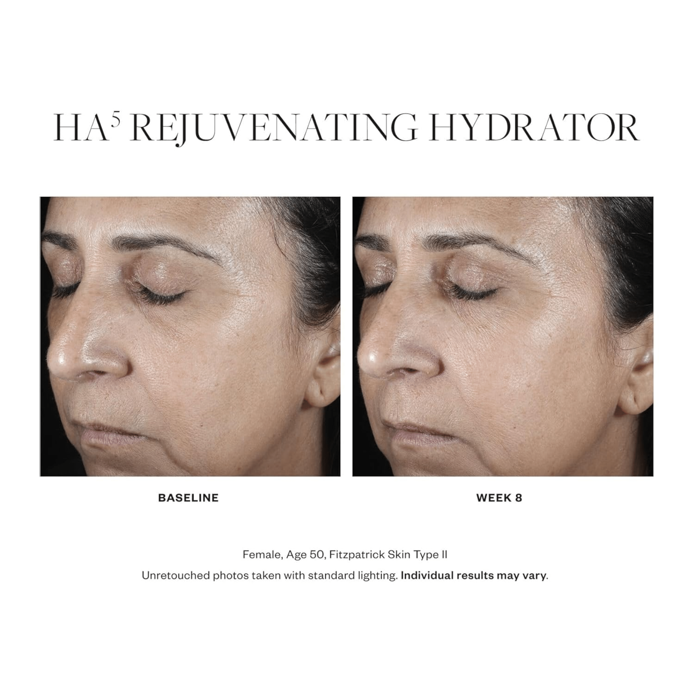 SkinMedica HA5® Rejuvenating Hydrator - Moisturizers | MacroPanora
