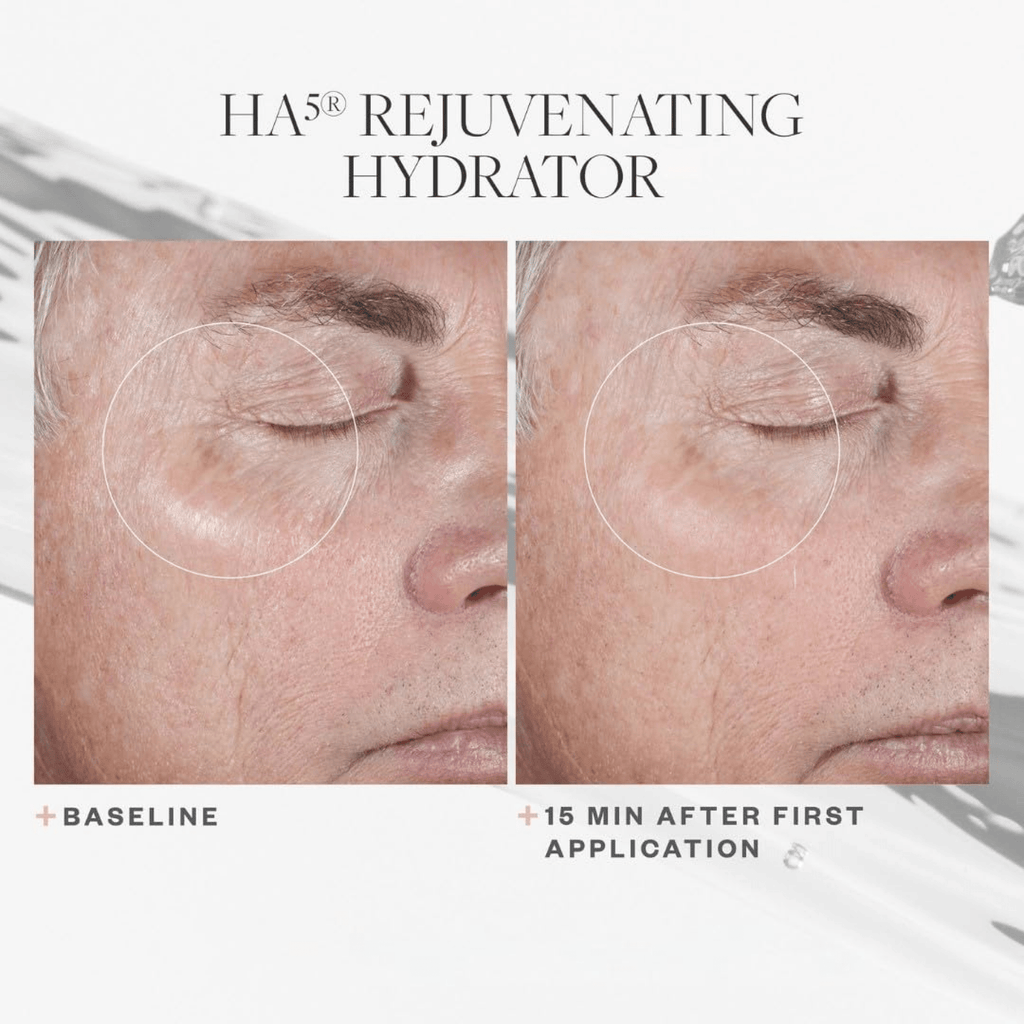 SkinMedica HA5® Rejuvenating Hydrator - Moisturizers | MacroPanora