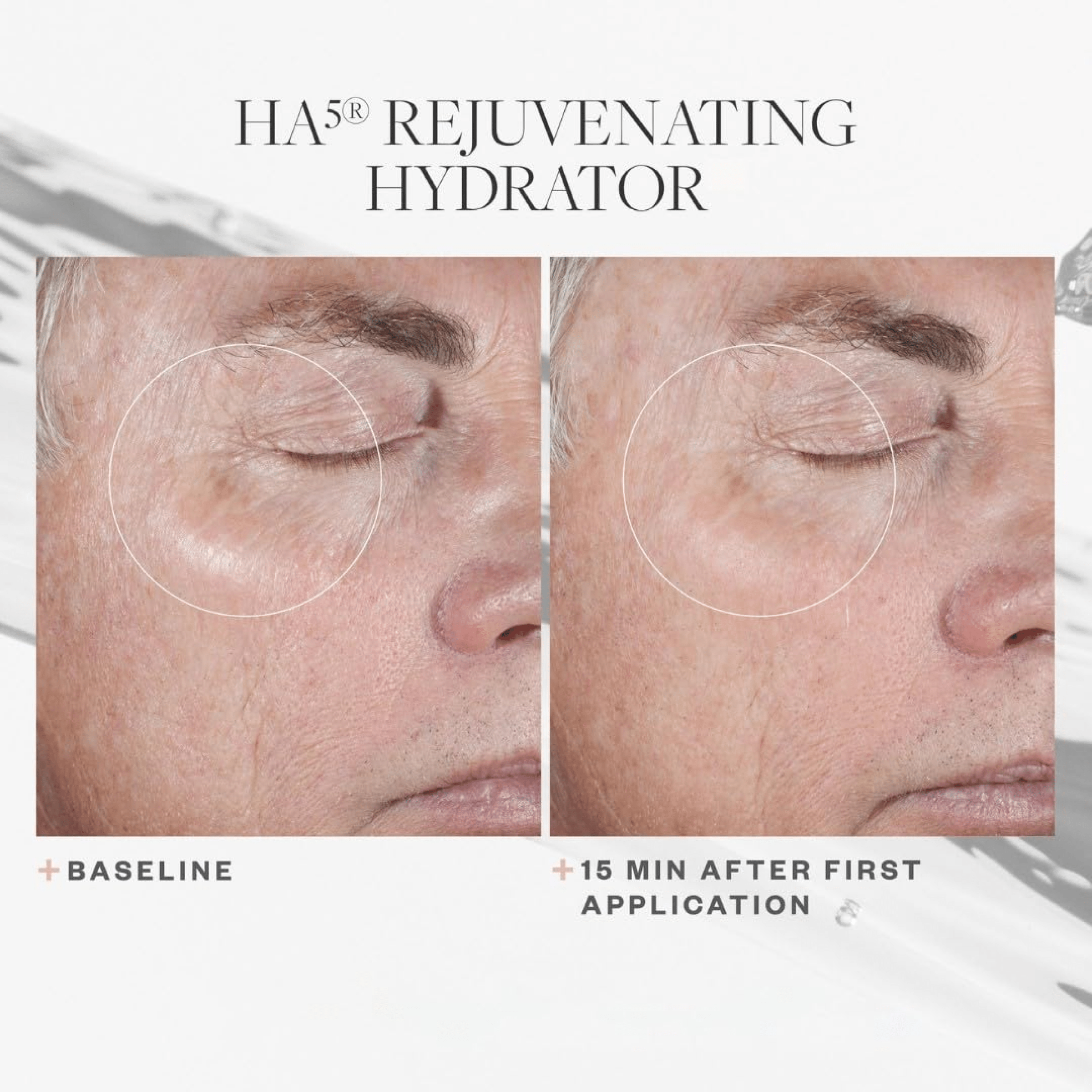 SkinMedica HA5® Rejuvenating Hydrator - Moisturizers | MacroPanora