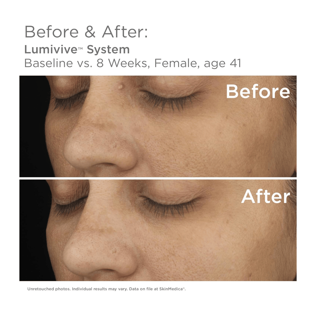 SkinMedica Lumivive™ System - Programs & Kits | MacroPanora