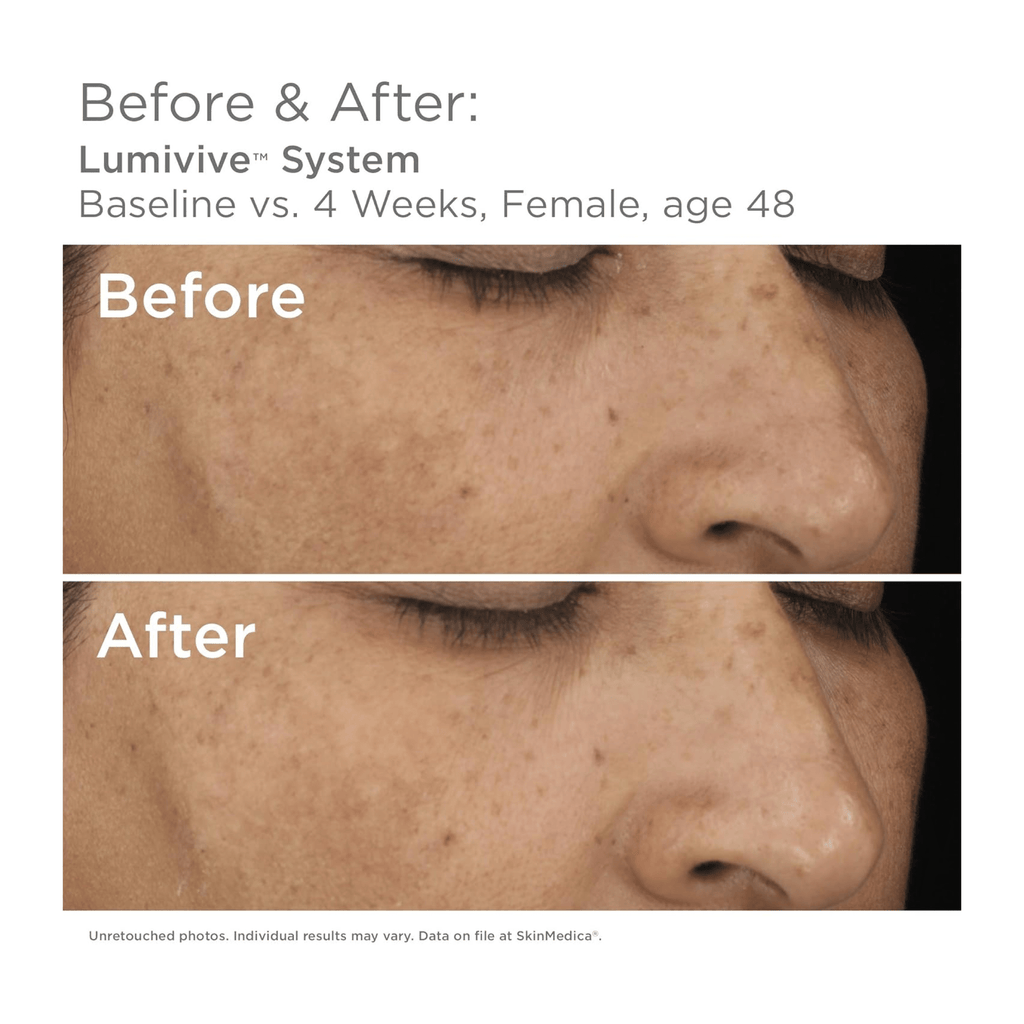 SkinMedica Lumivive™ System - Programs & Kits | MacroPanora