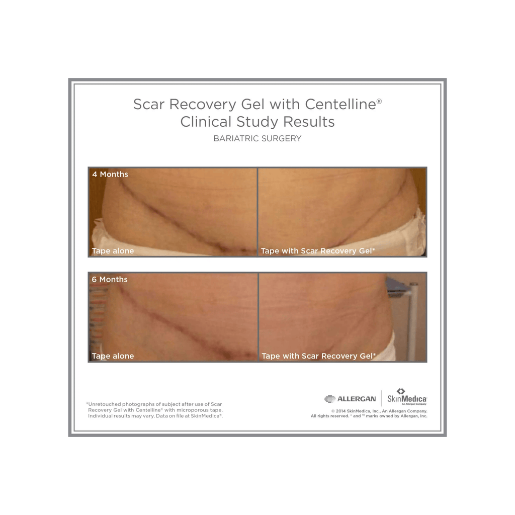 SkinMedica Scar Recovery Gel with Centelline® - Post-Procedure Care | MacroPanora