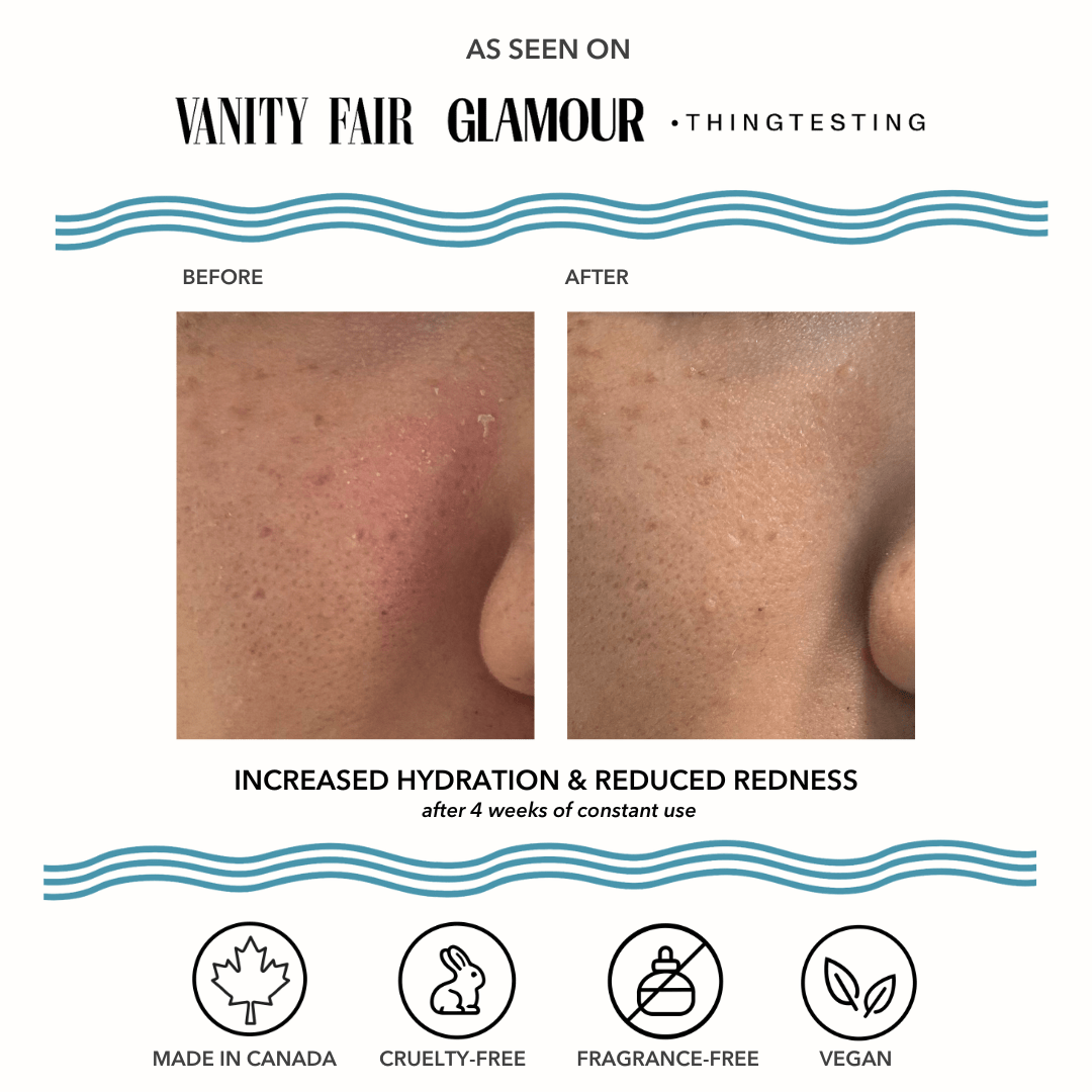 Vacation Skin Redness Recovery Overnight Mask and Moisturizer - MacroPanora